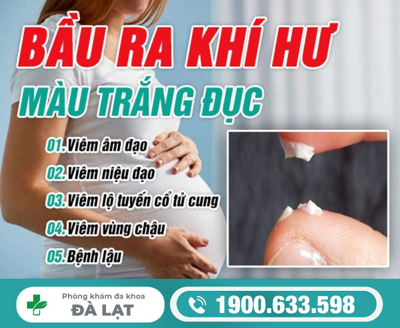 Hình ảnh minh họa